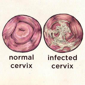 hpv-testing-near-me