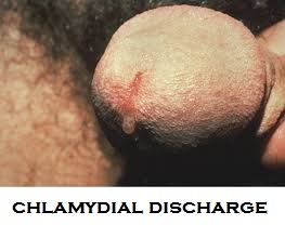 chlamydia-on-penis