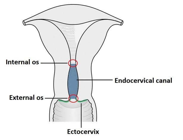Cervical-Ectopy-chlamydia-teen-young-girlsa