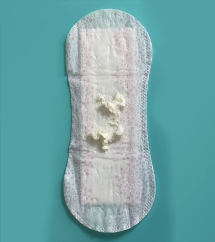 white-creamy-vaginal-discharge