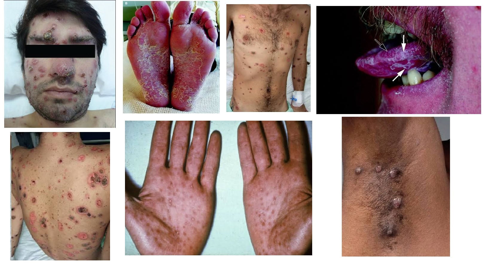 risk of HIV transmission to others.